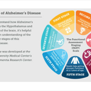 The REAL Seven Stages of Alzheimer’s