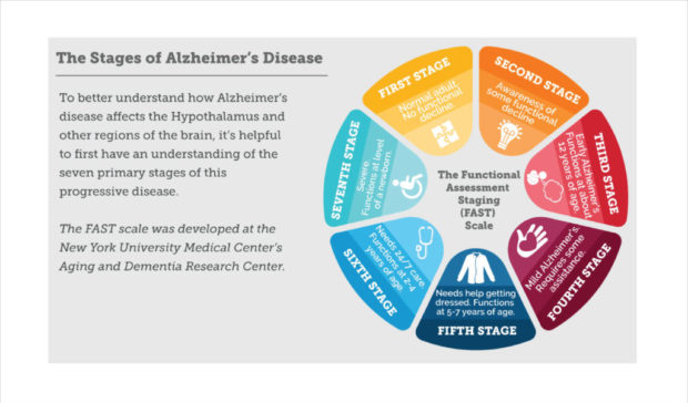 The REAL Seven Stages of Alzheimer’s